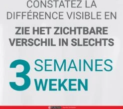 Purina One Sensitive - Kalkoen/Rijst - Kattenvoer - 800 G -Kattenbenodigdheden 1200x1063